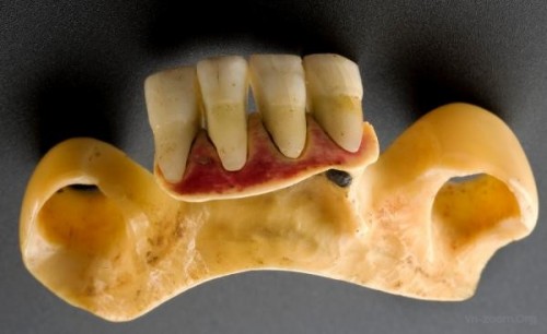 creepy-medical-facts.jpg