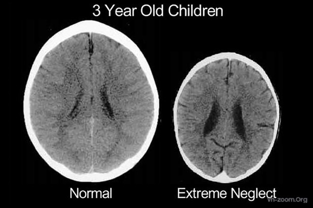 171102-toddler-brain-scans-embed.jpg