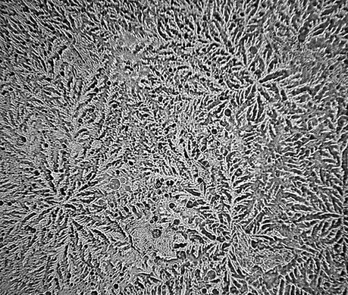 human-tears-under-microscope-2a-onion-tears.jpg