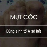 Mn-coc---sinh-t-A