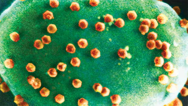 Chlorovirus.jpg